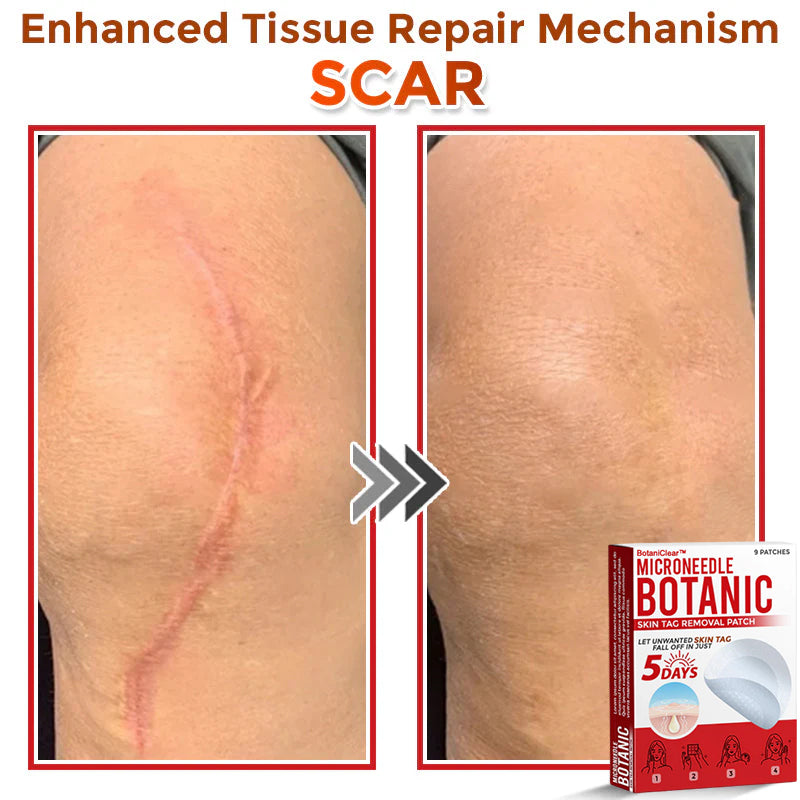 🌿 BotaniClear™ USA-Made MicroNeedle Patch for Skin Tags | Natural Removal in Just 5 Days