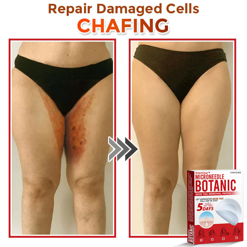 🌿 BotaniClear™ USA-Made MicroNeedle Patch for Skin Tags | Natural Removal in Just 5 Days