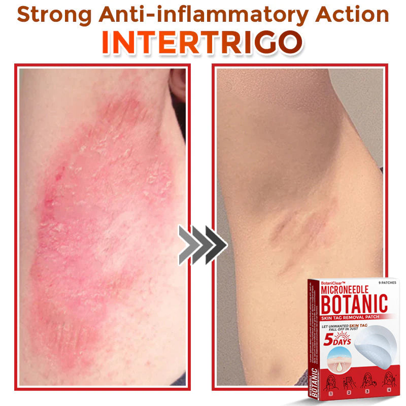 🌿 BotaniClear™ USA-Made MicroNeedle Patch for Skin Tags | Natural Removal in Just 5 Days